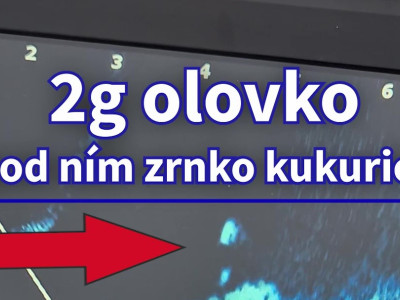 🏆 Neuveriteľná Citlivosť Sonaru: Vidíme Každú 2mm Peletu! 🤯 (Live Sonar Test) #sonary #live 🏆 Neuveriteľná Citlivosť Sonaru: Vidíme Každú 2mm Peletu! 🤯 (Live Sonar Test) #sonary #live